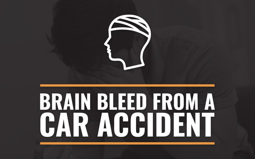 Brain Bleed From a Car Accident: Everything You Should Know