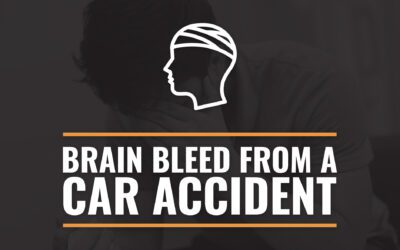 Brain Bleed From a Car Accident: Everything You Should Know