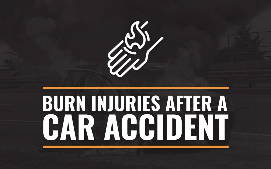 Burn Injuries From A Car Accident: Types & Treatment